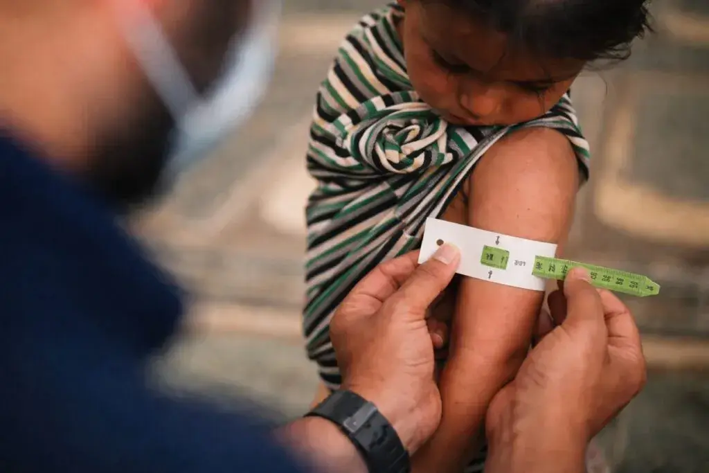 Malnutrición señales en niño durante medición de brazo reflejan impacto en salud y nutrición en Cuba